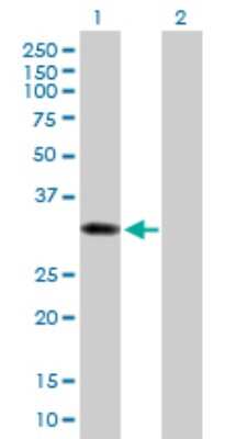 Western Blot: Cytosolic Sulfotransferase 1B1/SULT1B1 Antibody [H00027284-B02P] - Analysis of SULT1B1 expression in transfected 293T cell line by SULT1B1 polyclonal antibody.  Lane 1: SULT1B1 transfected lysate(32.56 KDa). Lane 2: Non-transfected lysate.