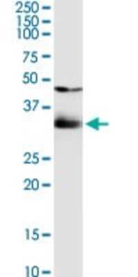 Western Blot: Cytosolic Sulfotransferase 1B1/SULT1B1 Antibody [H00027284-D01P] - Analysis of SULT1B1 expression in Hela S3 NE.