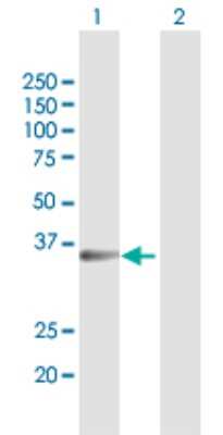 Western Blot: Cytosolic Sulfotransferase 1B1/SULT1B1 Antibody [H00027284-D01P] - Analysis of SULT1B1 expression in transfected 293T cell line by SULT1B1 polyclonal antibody.Lane 1: SULT1B1 transfected lysate(34.90 KDa).Lane 2: Non-transfected lysate.