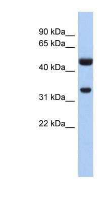 Western Blot: Cytosolic Sulfotransferase 1B1/SULT1B1 Antibody [NBP1-54403] - Titration: 0.2-1 ug/ml, Positive Control: Human Intestine.