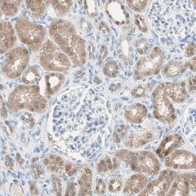 Immunohistochemistry-Paraffin: Cytosolic Sulfotransferase 1C2/SULT1C2 Antibody [NBP1-86994] - Staining of human kidney shows moderate cytoplasmic positivity in cells in tubules.