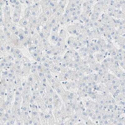 Immunohistochemistry-Paraffin: Cytosolic Sulfotransferase 1C2/SULT1C2 Antibody [NBP1-86994] - Staining of human liver shows no positivity in hepatocytes as expected.