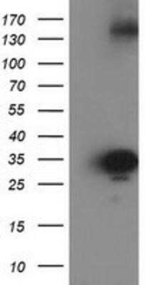 Western Blot: Cytosolic Sulfotransferase 1C2/SULT1C2 Antibody (OTI4G1) - Azide and BSA Free [NBP2-71313] - HEK293T cells were transfected with the pCMV6-ENTRY control (Left lane) or pCMV6-ENTRY SULT1C2 (Right lane) cDNA for 48 hrs and lysed. Equivalent amounts of cell lysates (5 ug per lane) were separated by SDS-PAGE and immunoblotted with anti-SULT1C2.