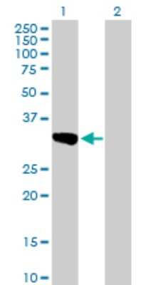 Western Blot: Cytosolic Sulfotransferase 1C2/SULT1C2 Antibody [H00006819-B01P] - Analysis of SULT1C2 expression in transfected 293T cell line by SULT1C2 polyclonal antibody.  Lane 1: SULT1C1 transfected lysate(32.67 KDa). Lane 2: Non-transfected lysate.
