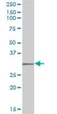 Western Blot: Cytosolic Sulfotransferase 1C2/SULT1C2 Antibody [H00006819-B02P] - Analysis of SULT1C1 expression in human stomach.