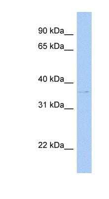 Western Blot: Cytosolic Sulfotransferase 1C2/SULT1C2 Antibody [NBP1-53102] - Hela cell lysate, concentration 0.2-1 ug/ml.