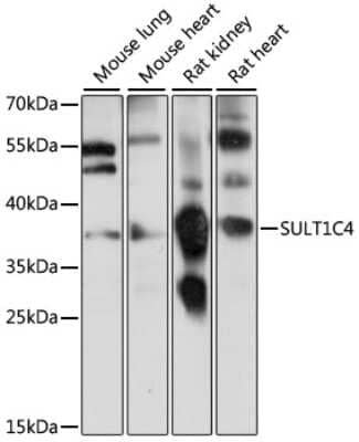 Western Blot: Cytosolic Sulfotransferase 1C4/SULT1C4 Antibody [NBP2-92232] - Analysis of extracts of various cell lines, using Cytosolic Sulfotransferase 1C4/SULT1C4 at 1:1000 dilution. Secondary antibody: HRP Goat Anti-Rabbit IgG (H+L) at 1:10000 dilution. Lysates/proteins: 25ug per lane. Blocking buffer: 3% nonfat dry milk in TBST. Detection: ECL Basic Kit . Exposure time: 2s.