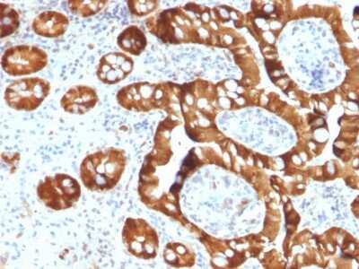 Immunohistochemistry-Paraffin: Cytosolic Sulfotransferase 1E1/SULT1E1 Antibody (CPTC-SULT1E1-1) - Azide and BSA Free [NBP3-08212] - Formalin-fixed, paraffin-embedded human Small Intestine stained with Cytosolic Sulfotransferase 1E1/SULT1E1 Mouse Monoclonal Antibody (CPTC-Cytosolic Sulfotransferase 1E1/SULT1E1-1).