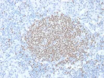 Immunohistochemistry-Paraffin: Cytosolic Sulfotransferase 1E1/SULT1E1 Antibody (CPTC-SULT1E1-1) - Azide and BSA Free [NBP3-08212] - Formalin-fixed, paraffin-embedded human Lymph Node stained with Cytosolic Sulfotransferase 1E1/SULT1E1 Mouse Monoclonal Antibody (CPTC-Cytosolic Sulfotransferase 1E1/SULT1E1-1).