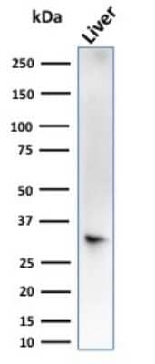 Western Blot: Cytosolic Sulfotransferase 1E1/SULT1E1 Antibody (CPTC-SULT1E1-1) - Azide and BSA Free [NBP3-08212] - Western Blot Analysis of liver tissue lysate using Cytosolic Sulfotransferase 1E1/SULT1E1 Mouse Monoclonal Antibody (CPTC-SULT1E1-1).