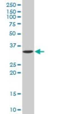 Western Blot: Cytosolic Sulfotransferase 1E1/SULT1E1 Antibody [H00006783-B01P] - Analysis of SULT1E1 expression in human liver.