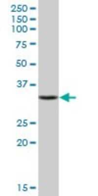 Western Blot: Cytosolic Sulfotransferase 1E1/SULT1E1 Antibody [H00006783-B02P] - Analysis of SULT1E1 expression in human liver.