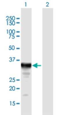 Western Blot: Cytosolic Sulfotransferase 1E1/SULT1E1 Antibody [H00006783-B02P] - Analysis of SULT1E1 expression in transfected 293T cell line by SULT1E1 polyclonal antibody.  Lane 1: SULT1E1 transfected lysate(32.34 KDa). Lane 2: Non-transfected lysate.