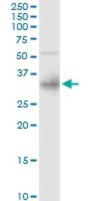 Western Blot: Cytosolic Sulfotransferase 1E1/SULT1E1 Antibody [H00006783-D01P] - Analysis of SULT1E1 expression in human liver.