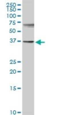 Western Blot: Cytosolic Sulfotransferase 1E1/SULT1E1 Antibody [H00006783-D01P] - Analysis of SULT1E1 expression in mouse testis.