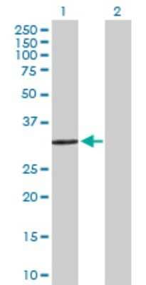 Western Blot: Cytosolic Sulfotransferase 1E1/SULT1E1 Antibody [H00006783-D01P] - Analysis of SULT1E1 expression in transfected 293T cell line by SULT1E1 polyclonal antibody.Lane 1: SULT1E1 transfected lysate(35.10 KDa).Lane 2: Non-transfected lysate.
