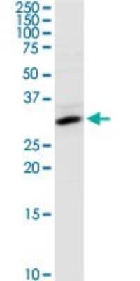 Western Blot: Cytosolic Sulfotransferase 1E1/SULT1E1 Antibody [H00006783-D02P] - Analysis of SULT1E1 expression in HeLa.