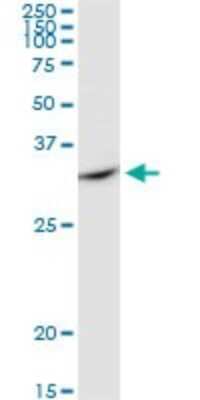 Western Blot: Cytosolic Sulfotransferase 1E1/SULT1E1 Antibody [H00006783-D02P] - Analysis of SULT1E1 expression in human kidney.
