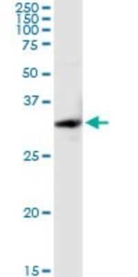 Western Blot: Cytosolic Sulfotransferase 1E1/SULT1E1 Antibody [H00006783-D02P] - Analysis of SULT1E1 expression in mouse brain.