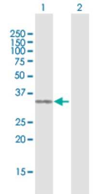 Western Blot: Cytosolic Sulfotransferase 1E1/SULT1E1 Antibody [H00006783-D02P] - Analysis of SULT1E1 expression in transfected 293T cell line by SULT1E1 polyclonal antibody.Lane 1: SULT1E1 transfected lysate(32.45 KDa).Lane 2: Non-transfected lysate.