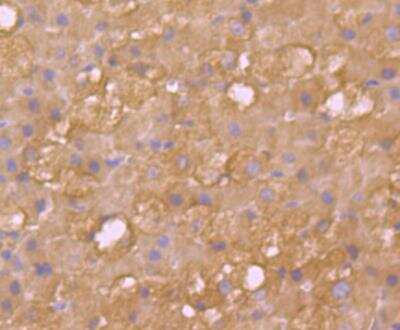 Immunohistochemistry: Cytosolic Sulfotransferase 2A1/SULT2A1 Antibody (JG36-18) [NBP2-76871] - Immunohistochemical analysis of paraffin-embedded rat adrenal gland tissue using anti-SULT2A1 antibody. Counter stained with hematoxylin.