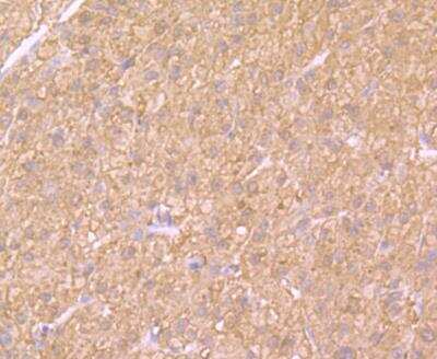 Immunohistochemistry: Cytosolic Sulfotransferase 2A1/SULT2A1 Antibody (JG36-18) [NBP2-76871] - Immunohistochemical analysis of paraffin-embedded human liver tissue using anti-SULT2A1 antibody. Counter stained with hematoxylin.