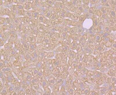 Immunohistochemistry: Cytosolic Sulfotransferase 2A1/SULT2A1 Antibody (JG36-18) [NBP2-76871] - Immunohistochemical analysis of paraffin-embedded mouse liver tissue using anti-SULT2A1 antibody. Counter stained with hematoxylin.