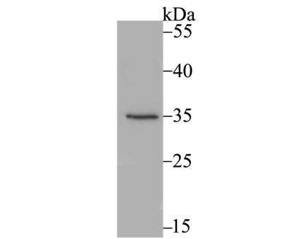 Western Blot: Cytosolic Sulfotransferase 2A1/SULT2A1 Antibody (JG36-18) [NBP2-76871] - Western blot analysis of SULT2A1 on mouse kidney tissue lysate using anti-SULT2A1 antibody at 1/1,000 dilution.