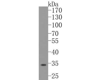 Western Blot: Cytosolic Sulfotransferase 2A1/SULT2A1 Antibody (JG36-18) [NBP2-76871] - Western blot analysis of Cytosolic Sulfotransferase 2A1/SULT2A1 on human liver tissue lysates. Proteins were transferred to a PVDF membrane and blocked with 5% BSA in PBS for 1 hour at room temperature. The primary antibody (1/500) was used in 5% BSA at room temperature for 2 hours. Goat Anti-Rabbit IgG - HRP Secondary Antibody (HA1001) at 1:200,000 dilution was used for 1 hour at room temperature.
