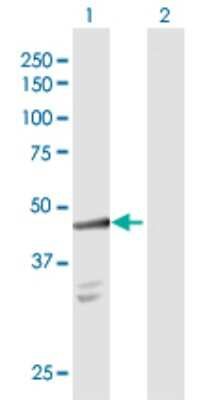 Western Blot: Cytosolic Sulfotransferase 2B1/SULT2B1 Antibody [H00006820-D01P] - Analysis of SULT2B1 expression in transfected 293T cell line by SULT2B1 polyclonal antibody.Lane 1: SULT2B1 transfected lysate(41.30 KDa).Lane 2: Non-transfected lysate.