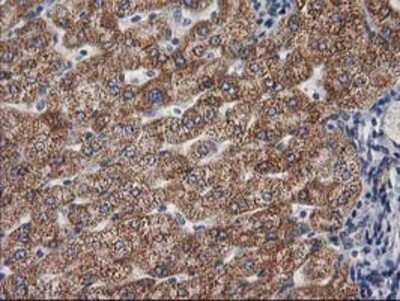 Immunohistochemistry: Cytosolic beta-Glucosidase/GBA3 Antibody (OTI1F1) - Azide and BSA Free [NBP2-72100] - Staining of paraffin-embedded Human liver tissue using anti-GBA3 mouse monoclonal antibody.