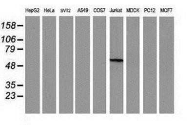 Western Blot: Cytosolic beta-Glucosidase/GBA3 Antibody (OTI1F1) - Azide and BSA Free [NBP2-72100] - Analysis of extracts (35ug) from 9 different cell lines by using anti-GBA3 monoclonal antibody.