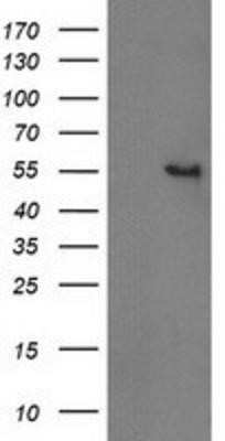 Western Blot: Cytosolic beta-Glucosidase/GBA3 Antibody (OTI1F1) - Azide and BSA Free [NBP2-72100] - HEK293T cells were transfected with the pCMV6-ENTRY control (Left lane) or pCMV6-ENTRY GBA3 (Right lane) cDNA for 48 hrs and lysed. Equivalent amounts of cell lysates (5 ug per lane) were separated by SDS-PAGE and immunoblotted with anti-GBA3.