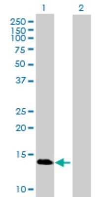 Western Blot: Cytosolic beta-Glucosidase/GBA3 Antibody [H00057733-B01P] - Analysis of GBA3 expression in transfected 293T cell line by GBA3 polyclonal antibody.  Lane 1: GBA3 transfected lysate(17.82 KDa). Lane 2: Non-transfected lysate.