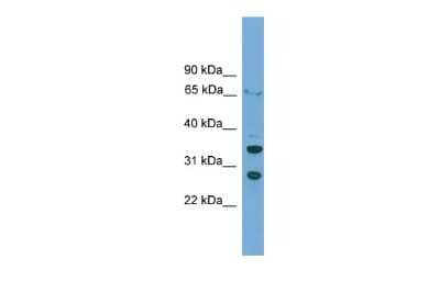 Western Blot: D Box Binding Protein Antibody [NBP2-83998] - WB Suggested Anti-DBP Antibody Titration: 0.2-1 ug/ml. ELISA Titer: 1:312500. Positive Control: HepG2 cell lysate