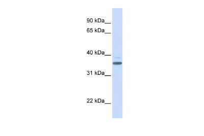 Western Blot: D Box Binding Protein Antibody [NBP2-83999] - WB Suggested Anti-DBP Antibody Titration: 0.2-1 ug/ml. ELISA Titer: 1:62500. Positive Control: Human heart