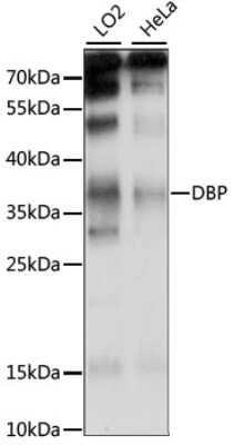 Western Blot: D Box Binding Protein Antibody [NBP2-92224] - Analysis of extracts of various cell lines, using D Box Binding Protein at 1:1000 dilution.Secondary antibody: HRP Goat Anti-Rabbit IgG (H+L) at 1:10000 dilution.Lysates/proteins: 25ug per lane.Blocking buffer: 3% nonfat dry milk in TBST.Detection: ECL Basic Kit .Exposure time: 15S.