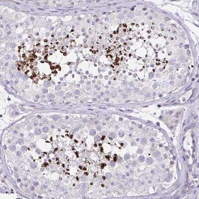 Immunohistochemistry-Paraffin: D2HGDH Antibody [NBP2-31631] - Staining of human testis shows strong cytoplasmic positivity in acrosomal cap in spermatids.