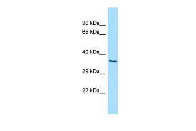 Western Blot: D2HGDH Antibody [NBP2-84756] - Host: Rabbit. Target Name: D2HGDH. Sample Type: 293T Whole Cell lysates. Antibody Dilution: 1.0ug/ml