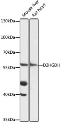 Western Blot: D2HGDH Antibody [NBP2-92309] - Analysis of extracts of various cell lines, using D2HGDH at 1:1000 dilution.Secondary antibody: HRP Goat Anti-Rabbit IgG (H+L) at 1:10000 dilution.Lysates/proteins: 25ug per lane.Blocking buffer: 3% nonfat dry milk in TBST.Detection: ECL Basic Kit .Exposure time: 90s.