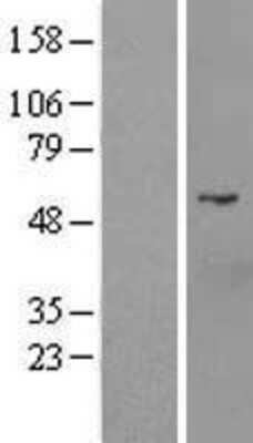 Western Blot: D2HGDH Overexpression Lysate (Adult Normal) [NBL1-09708] Left-Empty vector transfected control cell lysate (HEK293 cell lysate); Right -Over-expression Lysate for D2HGDH.