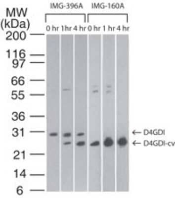 Western Blot: D4-GDI/RhoGDI2 Antibody (10D774) - Azide and BSA Free [NBP2-80690] - Analysis of D4GDI in Jurkat cells using NB100-56556 at 2 ug/ml and D4-GDI (cleavage specific) at 0.1 ug/ml. Cells were treated with 2 uM staurosporine for different time periods. NB100-56556 detects both the full-length and cleaved forms of D4GDI while D4-GDI (cleavage specific) specifically detects only the cleaved form of the protein. Image from the standard format of this antibody.