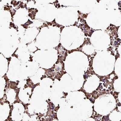 Immunohistochemistry-Paraffin: D4-GDI/RhoGDI2 Antibody [NBP2-33608] - Staining of human bone marrow shows strong cytoplasmic and nuclear positivity in hematopoietic cells.