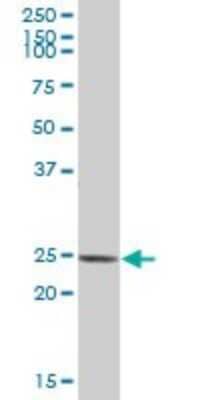 Western Blot: D4-GDI/RhoGDI2 Antibody [H00000397-B01P] - Analysis of ARHGDIB expression in human spleen.