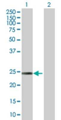 Western Blot: D4-GDI/RhoGDI2 Antibody [H00000397-B01P] - Analysis of ARHGDIB expression in transfected 293T cell line by ARHGDIB polyclonal antibody.  Lane 1: ARHGDIB transfected lysate(22.11 KDa). Lane 2: Non-transfected lysate.