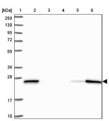 Western Blot: D4-GDI/RhoGDI2 Antibody [NBP2-33608] - Lane 1: Marker  [kDa] 250, 130, 95, 72, 55, 36, 28, 17, 10.  Lane 2: Human cell line RT-4.  Lane 3: Human cell line U-251MG sp.  Lane 4: Human plasma (IgG/HSA depleted).  Lane 5: Human liver tissue.  Lane 6: Human tonsil tissue