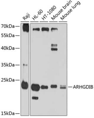 Western Blot: D4-GDI/RhoGDI2 Antibody [NBP2-92431] - Analysis of extracts of various cell lines, using D4-GDI/RhoGDI2 at 1:1000 dilution.Secondary antibody: HRP Goat Anti-Rabbit IgG (H+L) at 1:10000 dilution.Lysates/proteins: 25ug per lane.Blocking buffer: 3% nonfat dry milk in TBST.Detection: ECL Basic Kit .Exposure time: 30s.