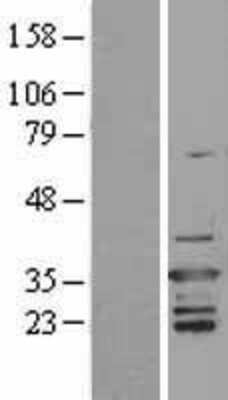 Western Blot: D4-GDI/RhoGDI2 Overexpression Lysate (Adult Normal) [NBL1-07674] Left-Empty vector transfected control cell lysate (HEK293 cell lysate); Right -Over-expression Lysate for D4-GDI/RhoGDI2.