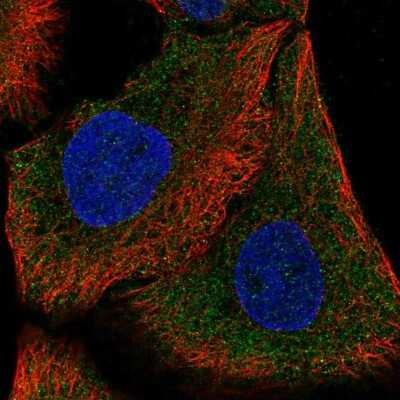 Immunocytochemistry/Immunofluorescence: DAAM1 Antibody [NBP2-57494] - Staining of human cell line HaCaT shows localization to cytosol.