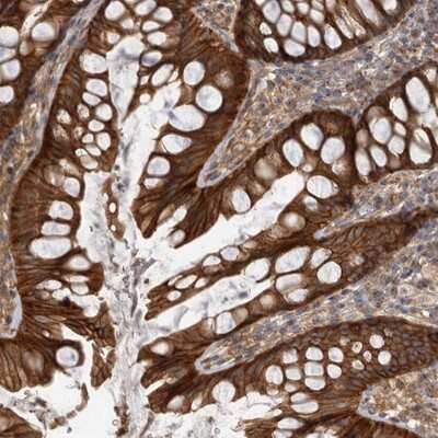 Immunohistochemistry-Paraffin: DAAM1 Antibody [NBP1-81492] - Staining of human colon shows strong cytoplasmic positivity in glandular cells.